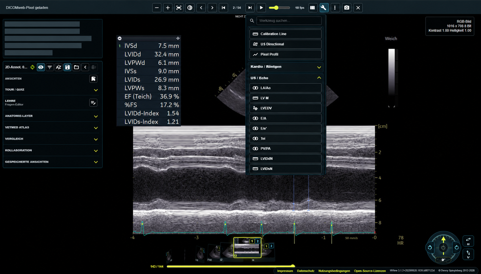 Ultraschall