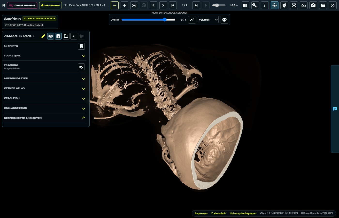 Echte 3D-Volumendarstellung einer CT-Serie in PawPacs/MView