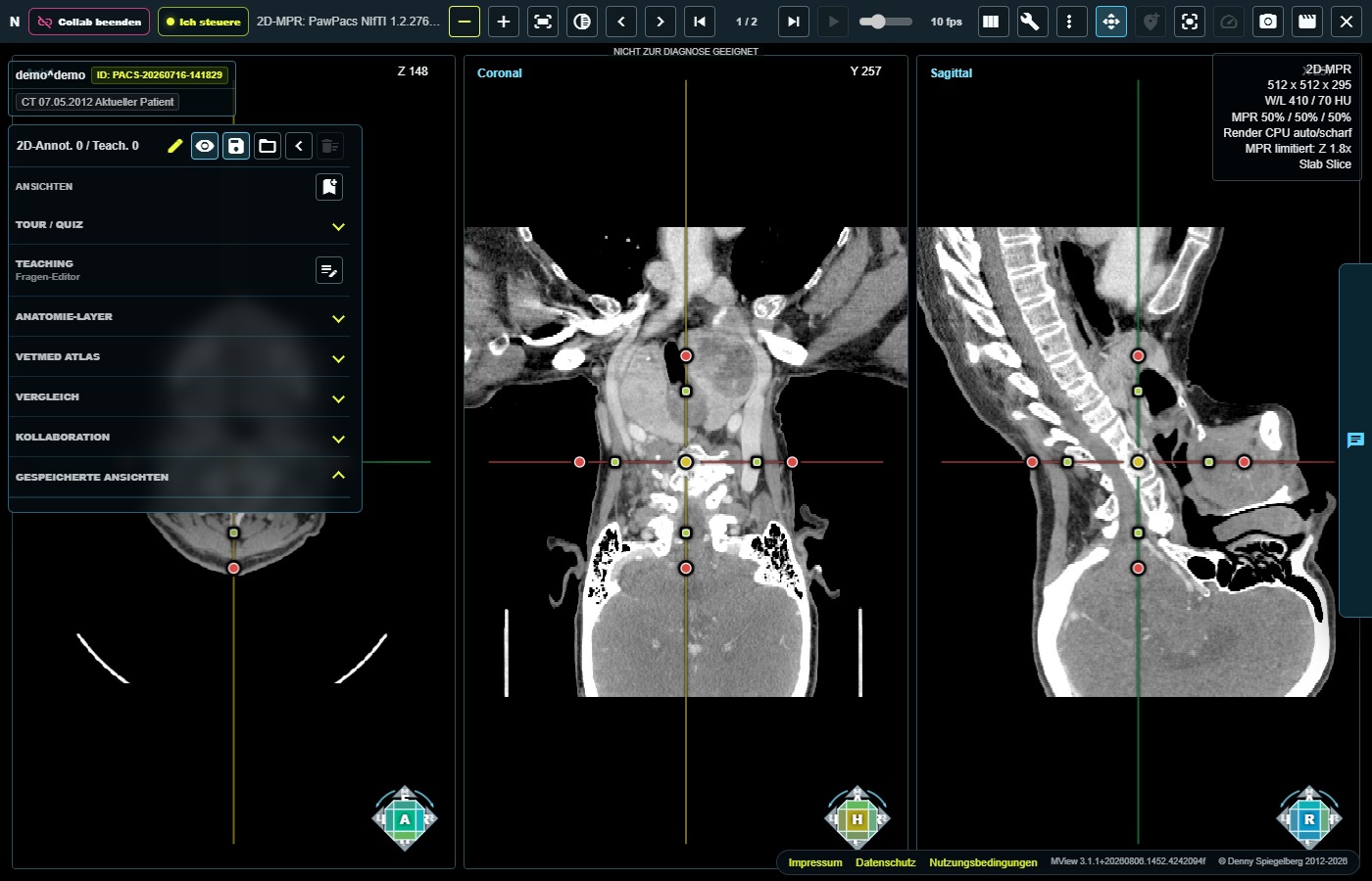Echte 2D-MPR-Darstellung einer CT-Serie in PawPacs/MView